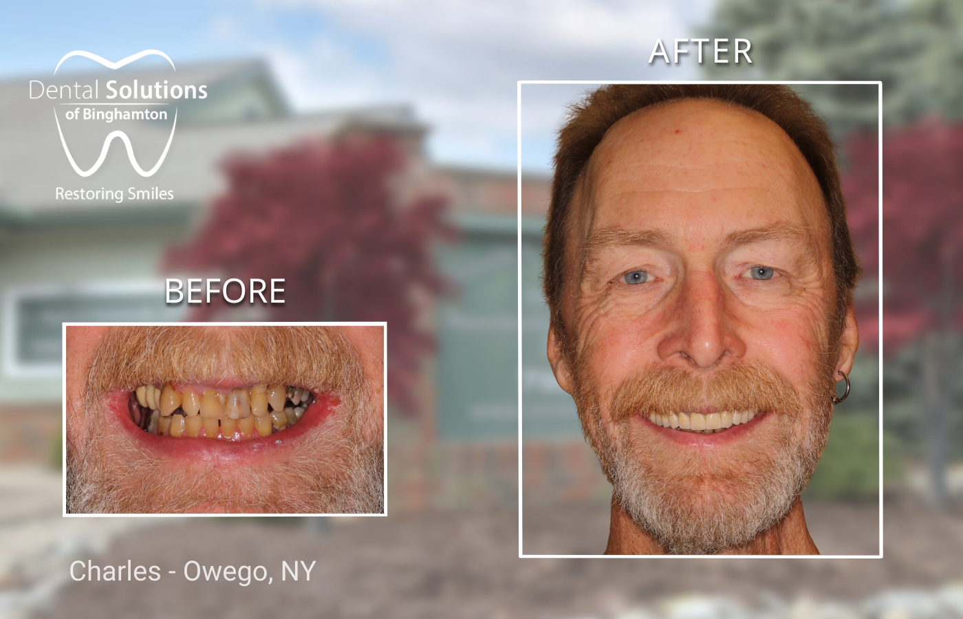 Cosmetic Gallery Serving Broome, Tompkins & Tioga Counties