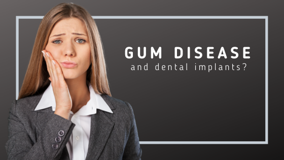 Read more about the article Gum Disease Concerns and Dental Implants?
